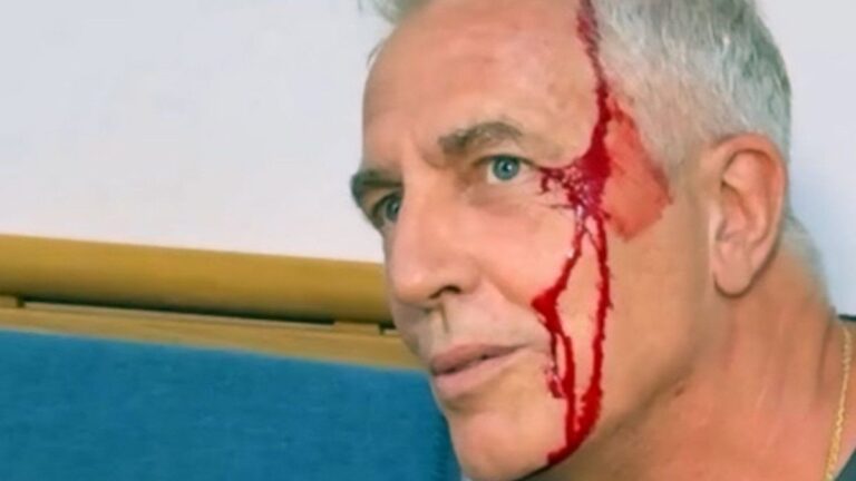 Marley se accidentó en Tailandia y terminó cubierto de sangre: qué le pasó