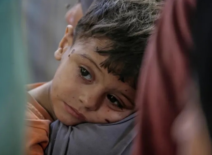 Por la guerra 21.000 niños quedaron discapacitados